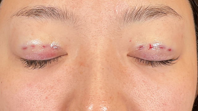 手术前的状态 其一