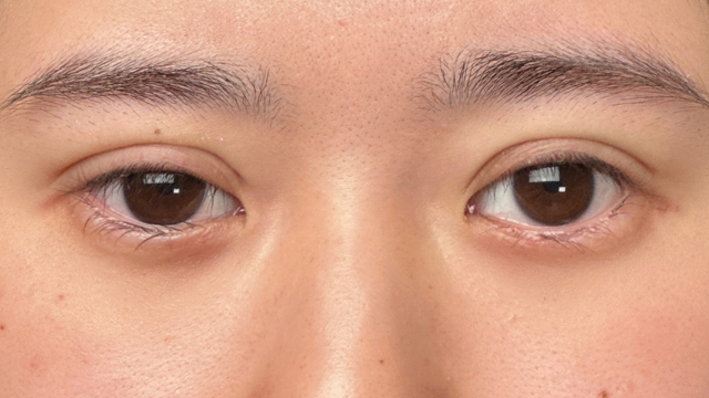 手术前的状态 其一