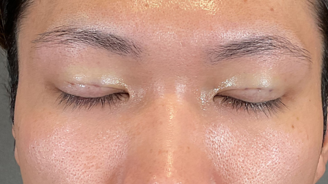 Postoperative Condition Part 1