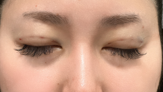 Postoperative Condition Part 1