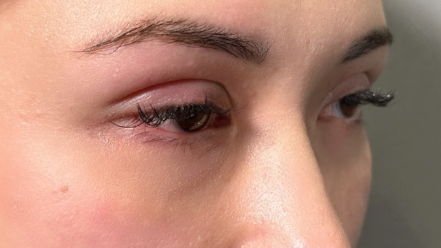 手术前的状态 其一