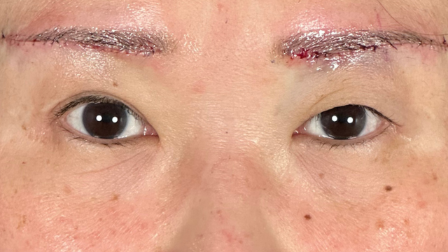 手术前的状态 其一