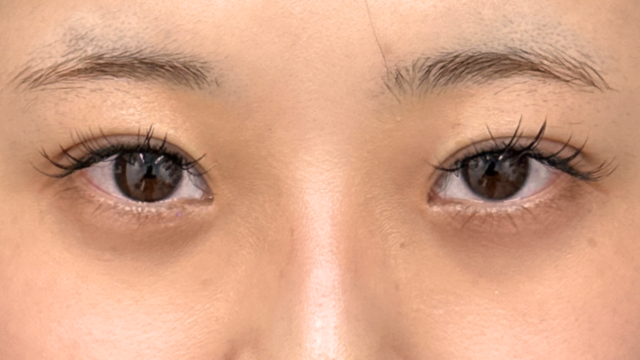 手术前的状态 其一