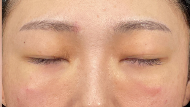 Postoperative Condition Part 1