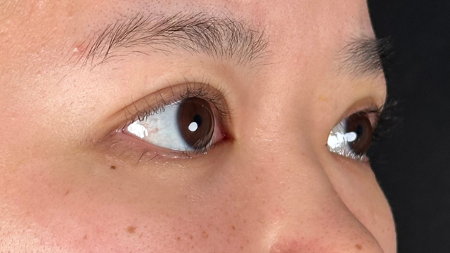 手术前的状态 其一