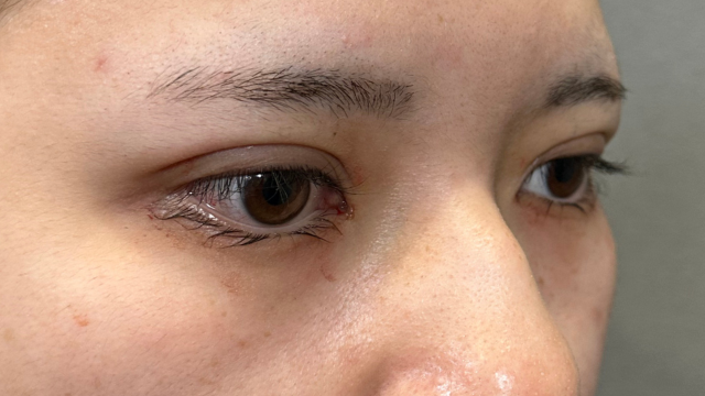 手術前の状態 その1