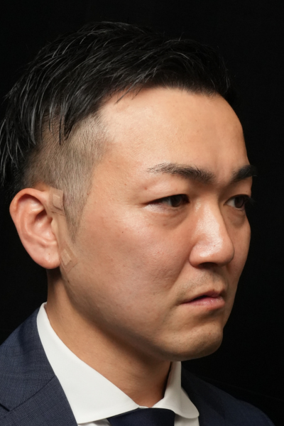 手術前の状態 その1