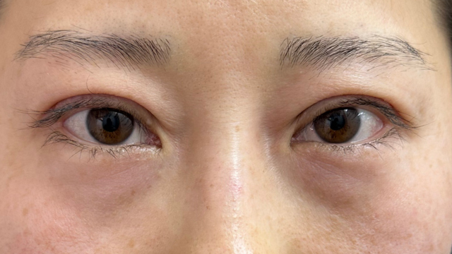 手术前的状态 其一