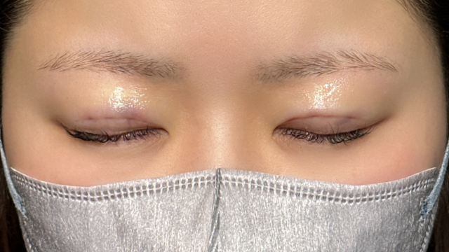 手术前的状态 其一