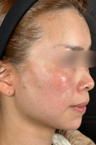 Postoperative Condition Part 1