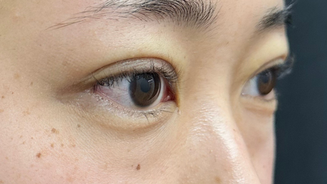 手术前的状态 其一