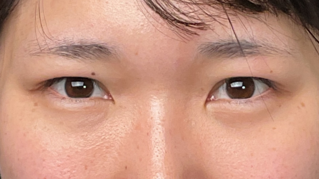 Postoperative Condition Part 1