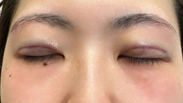 手术前的状态 其一