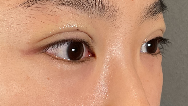 手术前的状态 其一