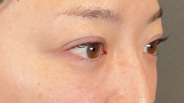 手术前的状态 其一