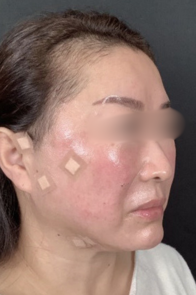 手術前の状態 その1