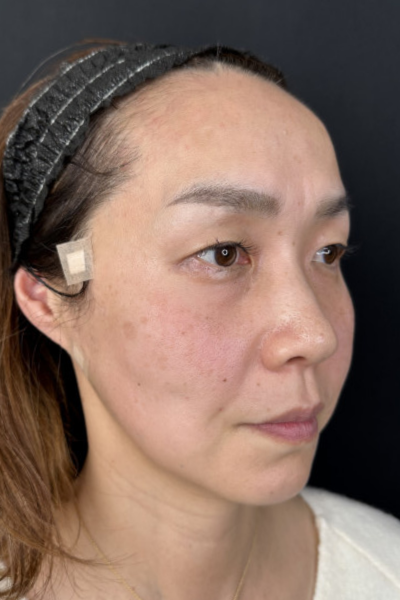 手术前的状态 其一