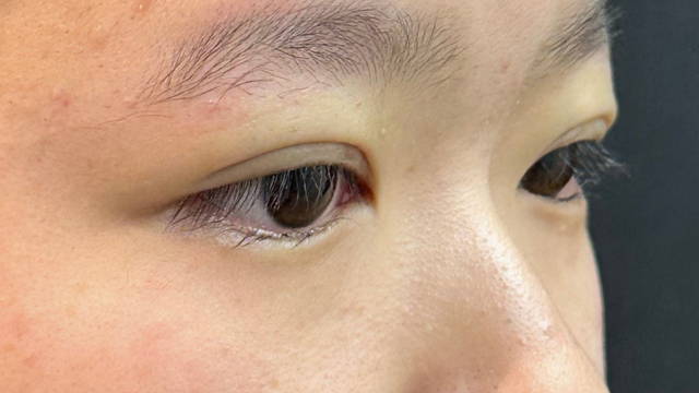 手术前的状态 其一