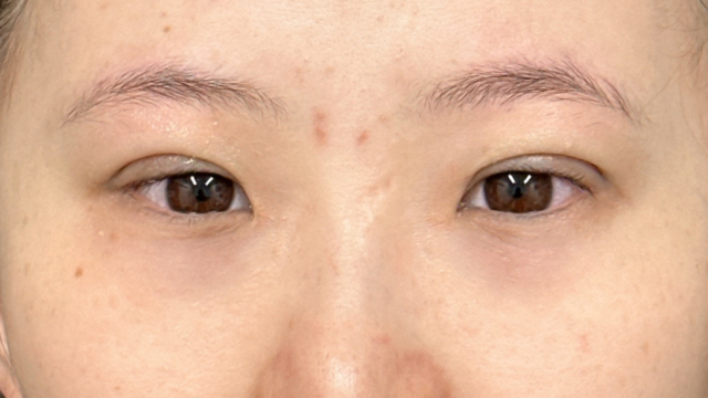 Postoperative Condition Part 1