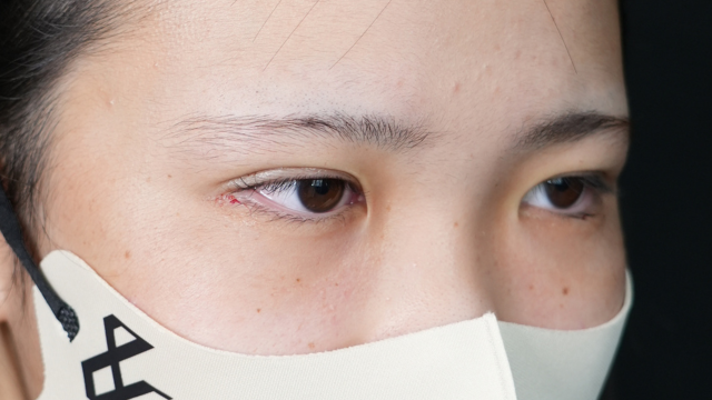 Postoperative Condition Part 1