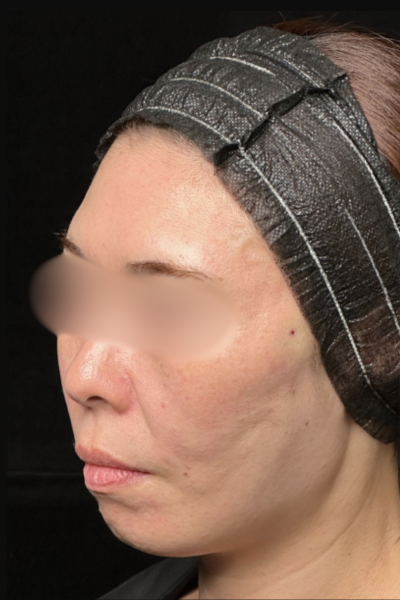 手術前の状態 その1