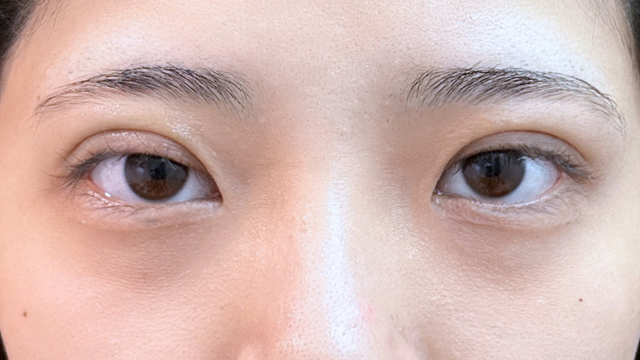 Postoperative Condition Part 1