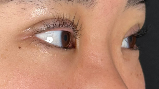 手术前的状态 其一