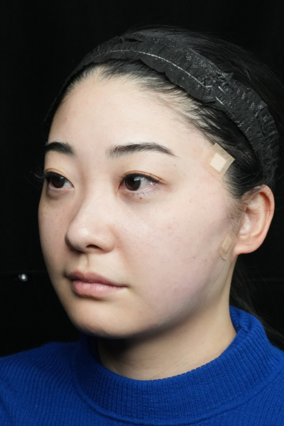 Postoperative Condition Part 1