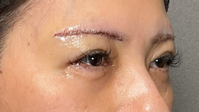 Postoperative Condition Part 1