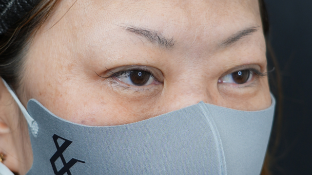 手术前的状态 其一