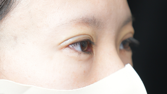 手术前的状态 其一