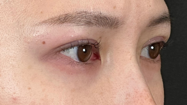 手术前的状态 其一