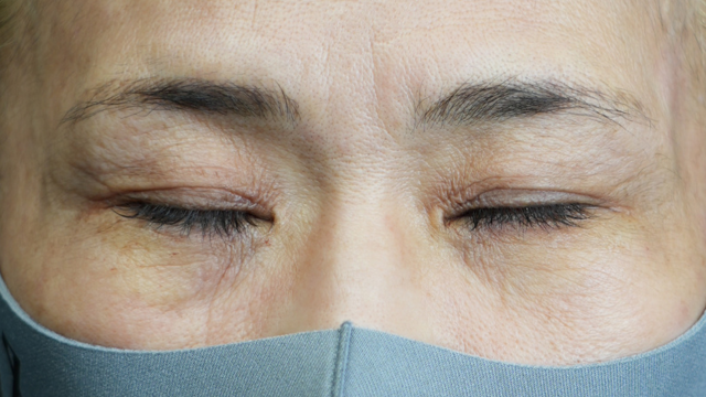 手术前的状态 其一