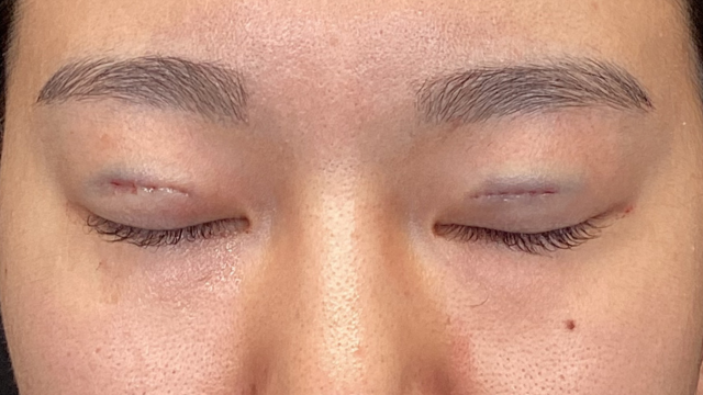 手術前の状態 その1