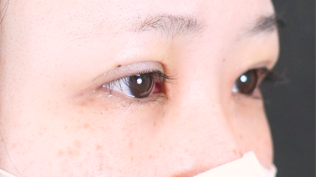 Postoperative Condition Part 1