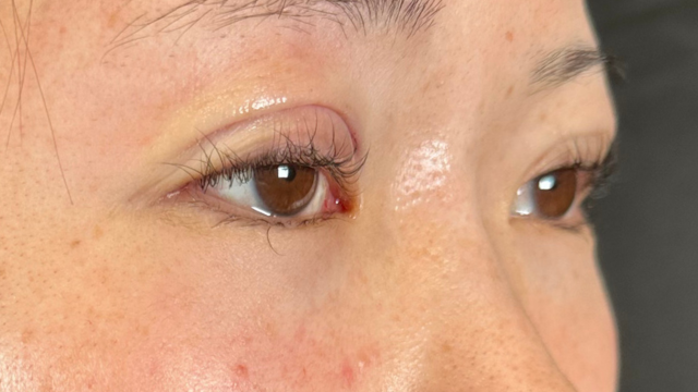 手术前的状态 其一