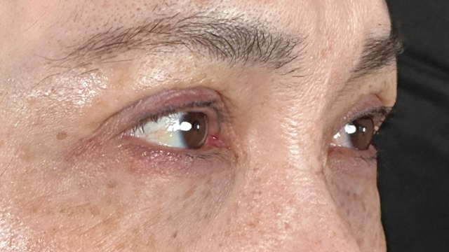 手术前的状态 其一