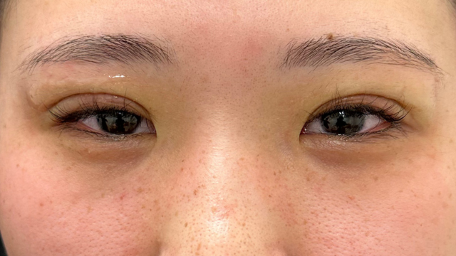 手术前的状态 其一