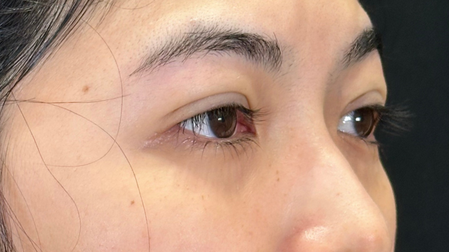 手术前的状态 其一