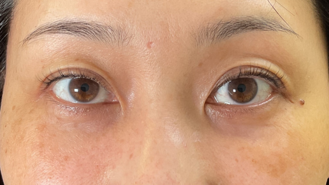 手术前的状态 其一