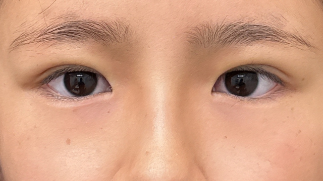 手术前的状态 其一