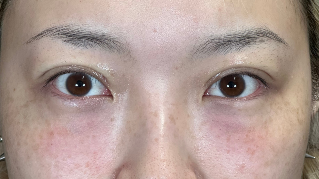 手术前的状态 其一