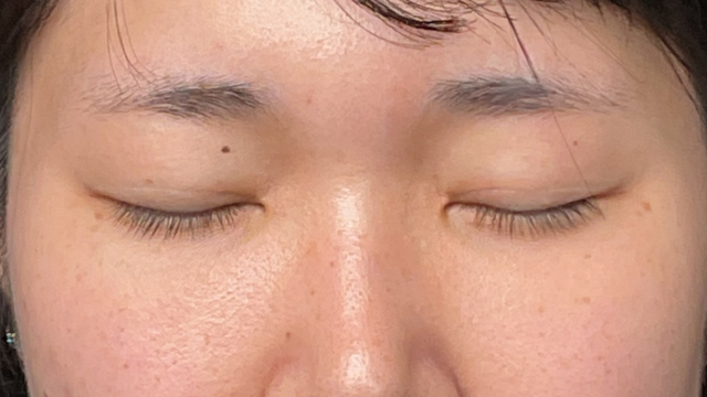 Postoperative Condition Part 1