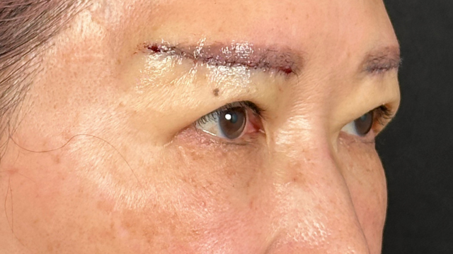 手術前の状態 その1