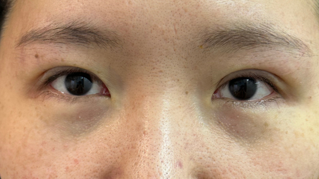 Postoperative Condition Part 1