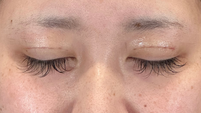 Postoperative Condition Part 1