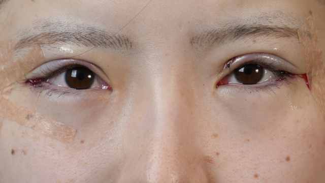 手術前の状態 その1