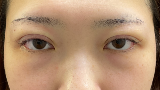 Postoperative Condition Part 1