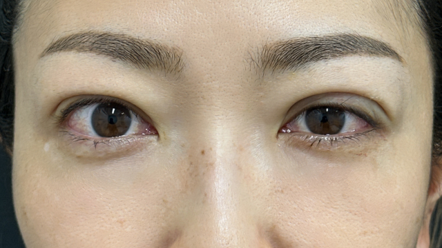 手术前的状态 其一