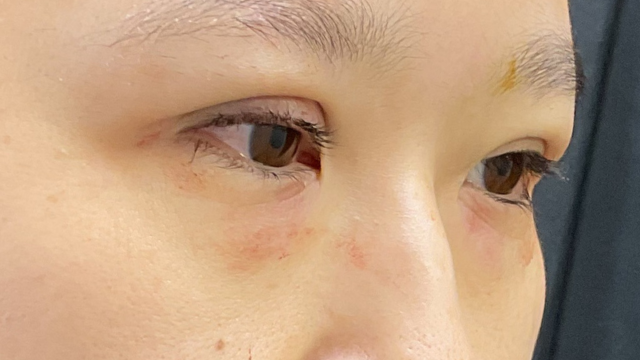 手术前的状态 其一